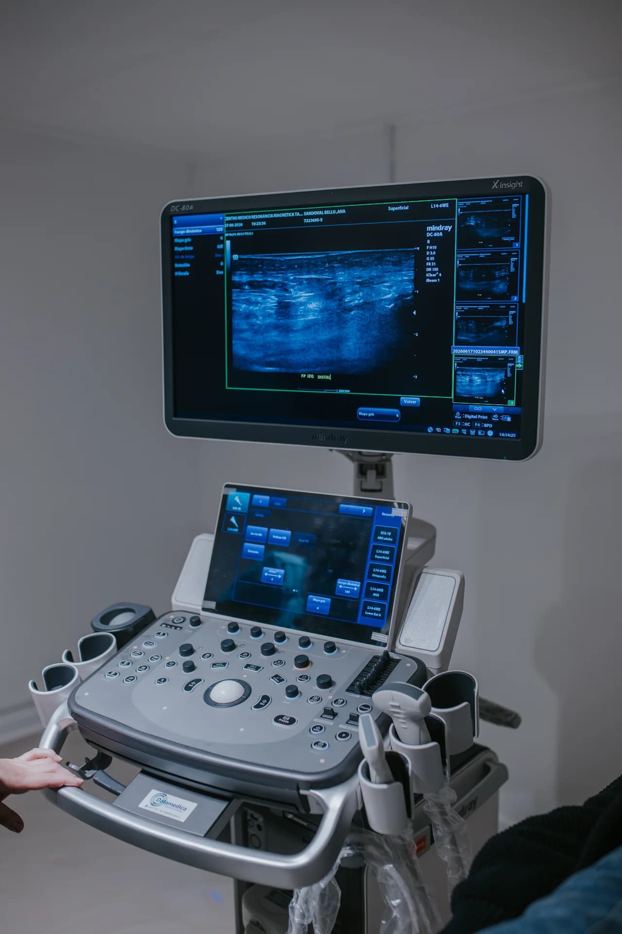 Vista vertical completa del ecógrafo de alta resolución